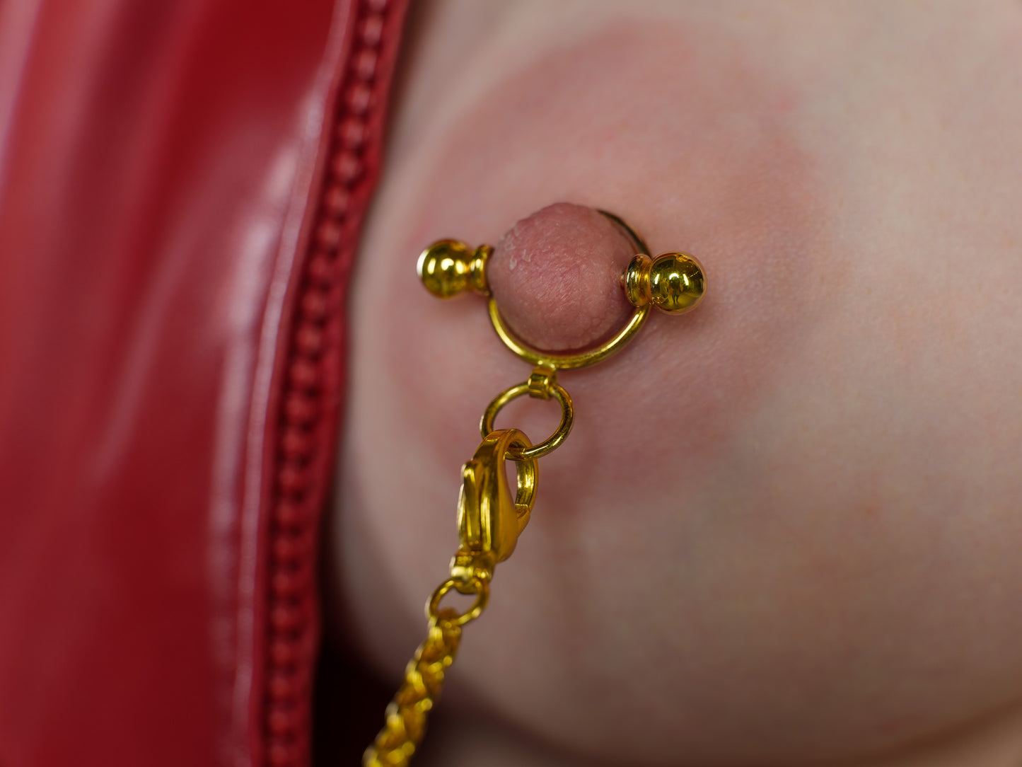 Breast Nipple Encirclement with Ring of O