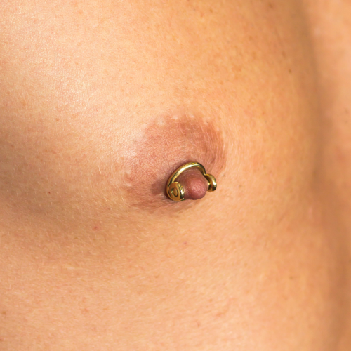 Breast nipple encirclement with screw-on bar